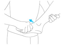 Posterior Tibialis Tendon Repair