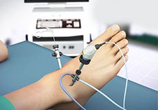 Revision Foot and Ankle Surgery