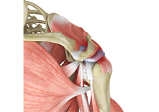 Rotator Cuff Re-tear