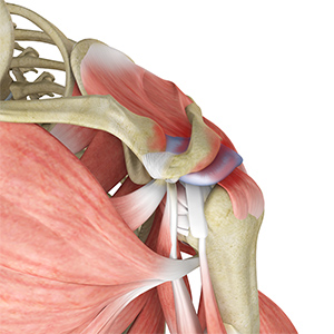 Rotator Cuff Re-tear