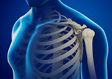 Shoulder Bursitis