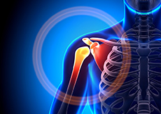 Shoulder Disorders