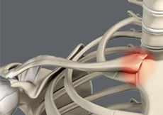Sternoclavicular(SC) Joint Injuries