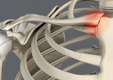 Sternoclavicular Joint (SC joint)