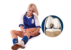 Women and ACL Injuries