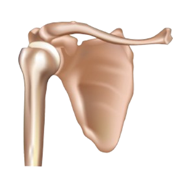 Shoulder Dislocation