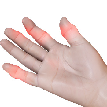 Finger Sprain