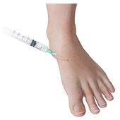 Foot Injections