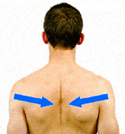 Rotator Cuff Tear
