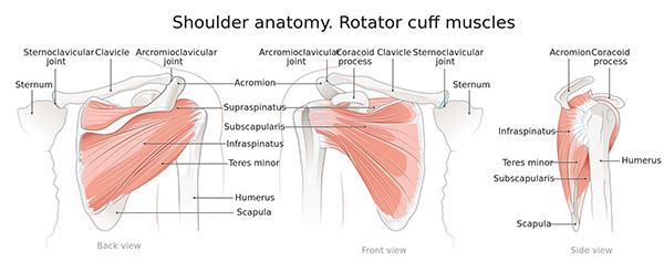 Rotator Cuff Tear
