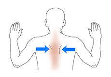 Exercises for Shoulder Impingement Syndrome