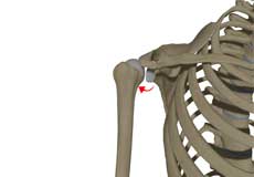 Posterolateral Instability