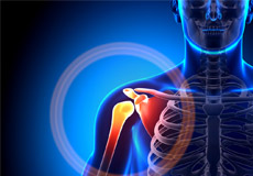 Shoulder Disorders