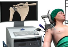 Shoulder Surgery