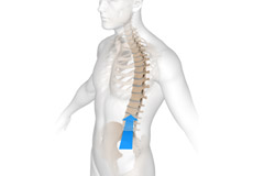 Oblique Lumbar Interbody Fusion