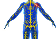 Peripheral Nerve Compression