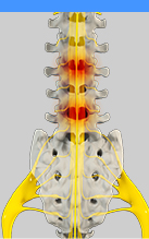 Spinal Oncology