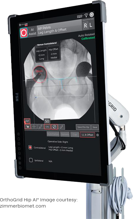 OrthoGrid Hip AI®  Advanced AI-Assisted Hip Replacement