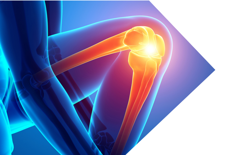 KNEE