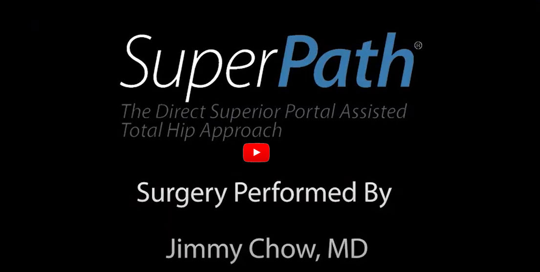 SuperPATH Live Surgery