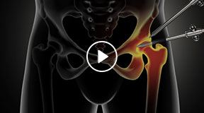 Patient Education Videos