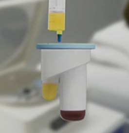 Regenerative Medicine