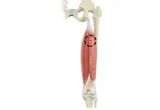 Hamstring Injuries