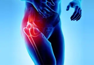 Hip Pain