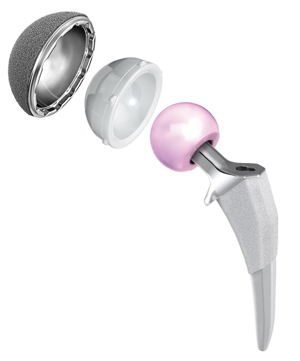 Total Hip Replacement Procedure