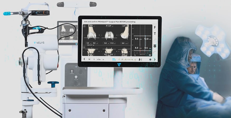 VELYS Robotic-Assisted Solution for Knee Replacement