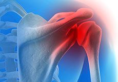 Baseball and Shoulder Injuries