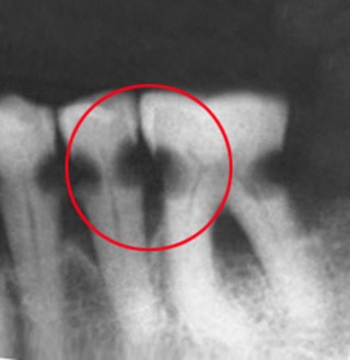 Dental X-ray