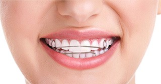 Orthodontics
