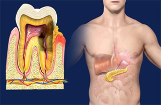 Periodontal Disease and Diabetes