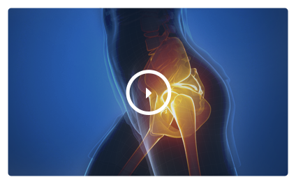 Patient Education Videos