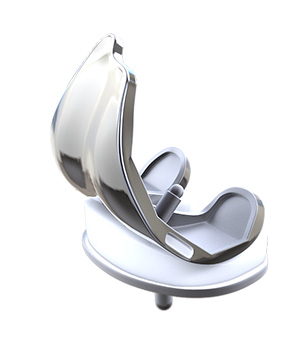 Total Knee Replacement