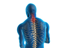 Neck Pain