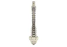 Scoliosis Treatment