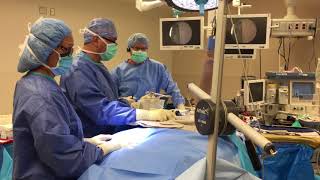 Standard Lateral Position For Shoulder Arthroscopy