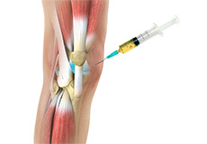 Orthobiologics for the Knee