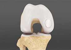 Orthobiologics