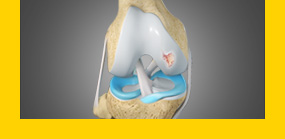 Advanced Transplantation Techniques