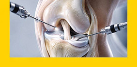 Minimally Invasive Surgical Options