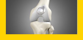 Advanced Knee Reconstruction