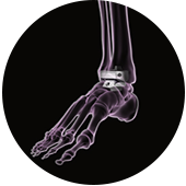 Foot and Ankle Procedures