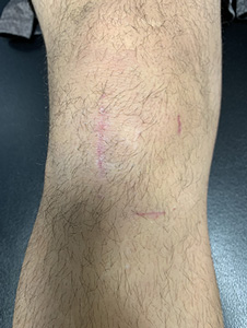 Treatment Philosophy picture1