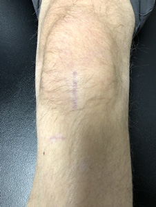 Treatment Philosophy picture2