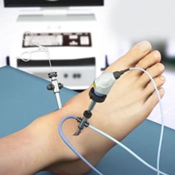 Ankle Arthroscopy