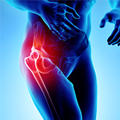 Hip Pain