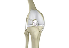 ACL Treatment